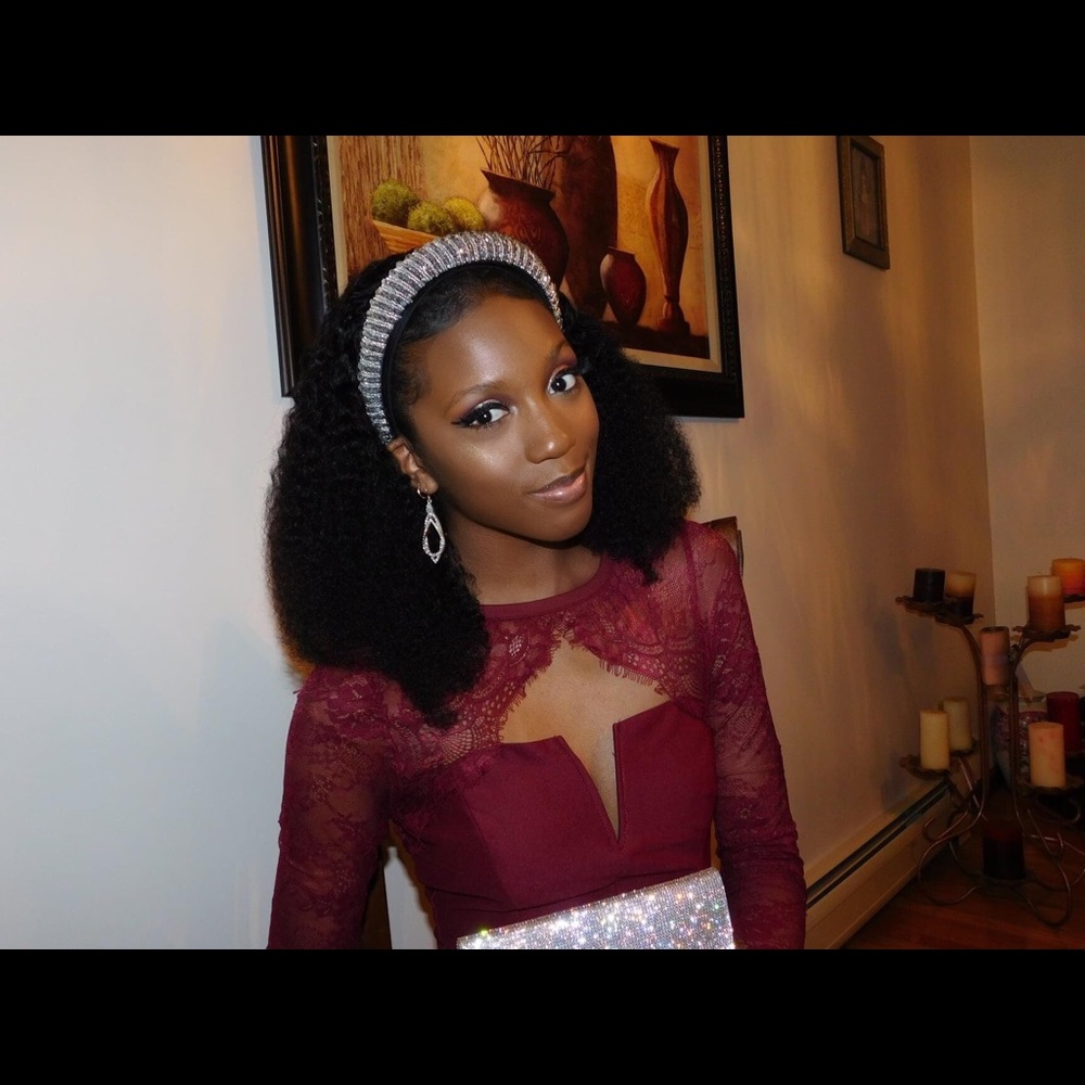 FN “Case of Lovers Lace Dress” ❤️ - Picture 8 of 8